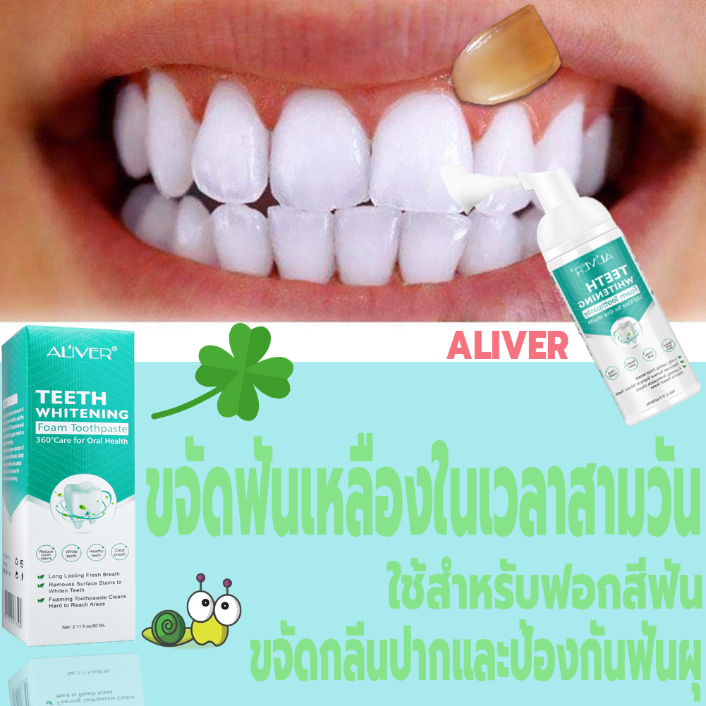 🔥ALIVER น้ำยาฟอกฟันขาว มูสแปรงฟัน ใช้สำหรับขจัดกลิ่นปาก ขจัดฟันเหลืองได้อย่างมีประสิทธิภาพ ป้องกันฟันผุและทำให้ลมหายใจสดชื่น (ยาสีฟันฟันขาว น้ำยาทำความสะอาดฟัน ยาสีฟัน ยาสีฟันฟอกฟันขาว น้ำยาฟอกสีฟัน เซรั่มฟอกฟันขาว ที่ฟอกฟันขาว)Mousse