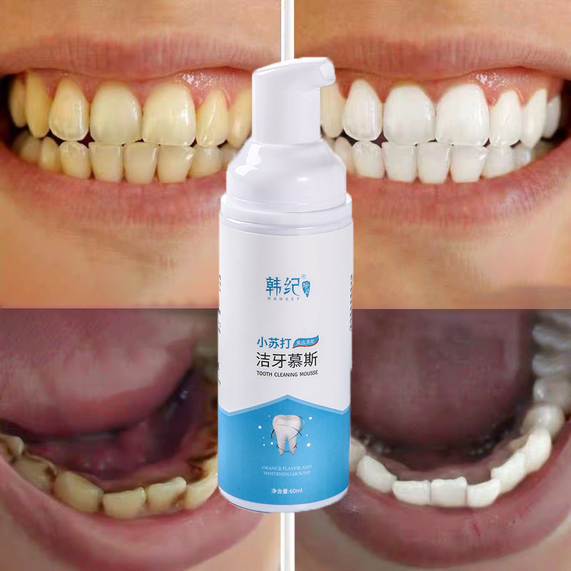 ยาสีฟันขจัดปูน ฟอกฟันขาว น้ำยาฟอกฟันขาว ยาสีฟันฟันขาว แก้ฟันดำและฟันเหลือง ขจัดคราบหินปูน บำรุงฟัน ยาสีฟันฟันขาว toothpaste