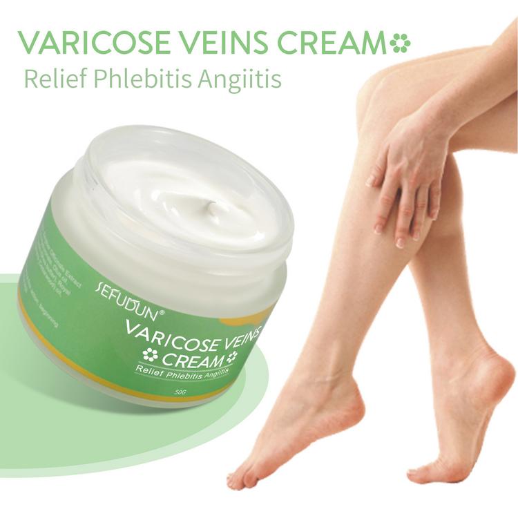 50g Varicose Vein Ointment Remove Red Blood Streaks Venae Veins ...