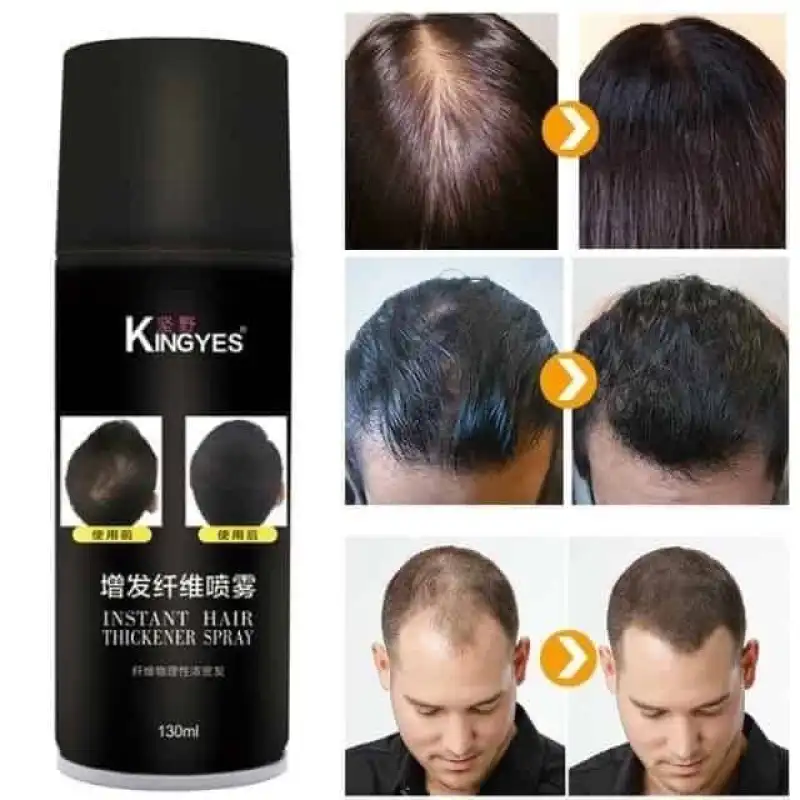 ภาพสินค้าkingyes hair spray สเปรย์ไฟเบอร์ผม สเปรย์แก้หัวล้าน สเปรย์ผมไฟเบอร์ ปิดผมบาง แก้ปัญหาหัวล้าน ผมบาง ขนาด 130 ml จากร้าน MAGICSHOP.TH บน Lazada ภาพที่ 4