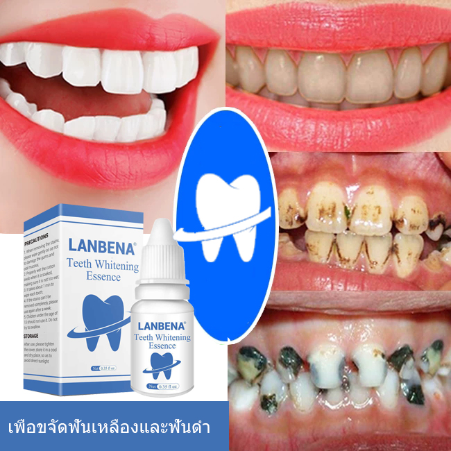 LANBENA เซรั่มไวท์เทนนิ่ง ลบคราบ ชา กาแฟ  ยาสีฟันฟอกขาว Oral Hygiene Cleaning Serum ยาฟอกฟันขาว Teeth Whitening Essence ฟัน  น้ำยาฟอกฟันขาว ยาสีฟันฟันขาว ยาสีฟัน