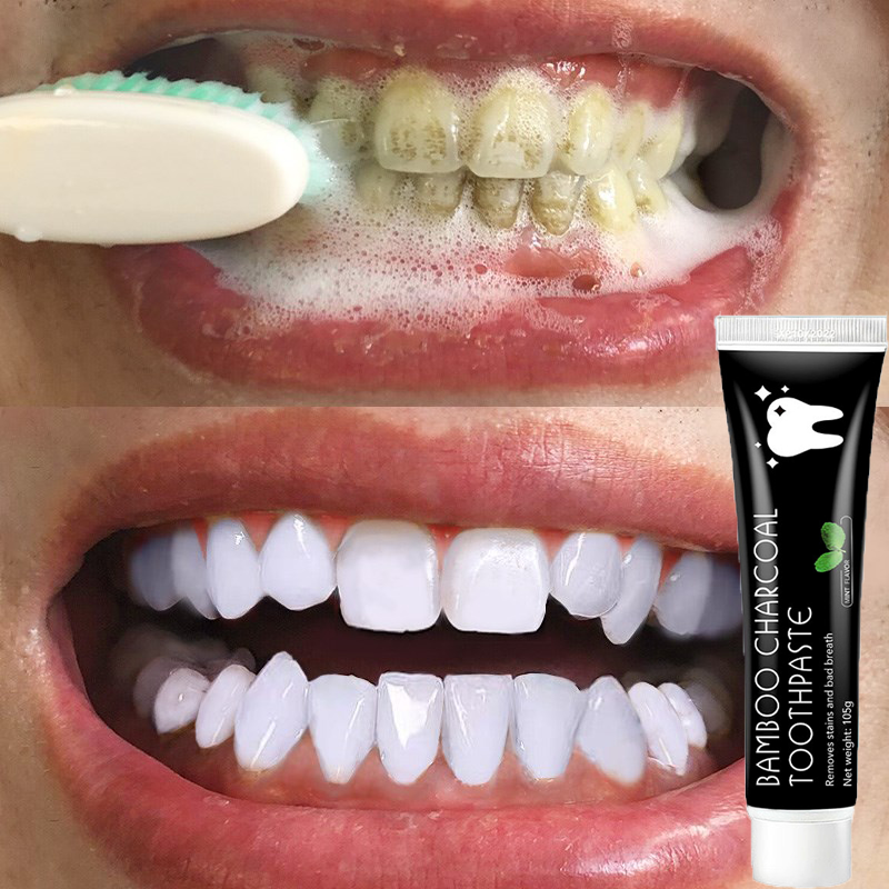 ฟอกฟันขาว ยาสีฟันฟันขาว ยาสีฟันแก้ฟันเหลือง ผลิตภัณฑ์ทำความสะอาดช่องปาก สูตรชาโคล รักษาเหงือก ฟันขาว ดับกลิ่นปาก ลมหายใจหอมสดชื่นยาสีฟันถ่านไม้ไผ่ ยาสีฟันฟันขาว ขจัดคราบ ยาสีฟันฟอกสีฟัน