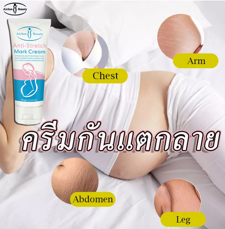 สูตรธรรมชาติบริสุทธิ์ แก้ท้องลาย ลดรอยแตกลาย ขาแตกลาย สะโพกลาย​ ผิวลาย รอย แตก​ลาย ให้ความชุ่มชื่นแก่ผิว เร่งการซ่อมแซมผิว เรียบริ้วรอย Aichun Stretch  Mark Cream 80G - Friza Carvey - Thaipick