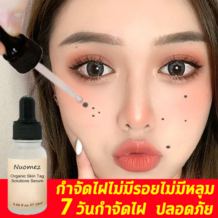 Nuomez ครีมแต้มไฝหูดติ่งเนื้อกำจัดขี้แมลงวันกระติ่งเนื้อตาปลาหลุดถอนรากถอนโคน ครีมแต้มไฝขี้แมลงวันติ่งเนื้อหูดตาปลากระหลุดทั้งราก ครีมไฝ ครีมกำจัดหูด ครีมกำจัดติ่งเนื้อ ตาปลา ครี 10ml