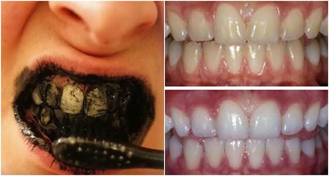 ผงขัดฟันชาร์โคล ผงถ่านชาร์โคลขัดฟันขาว Teeth Whitening ฟอกฟันขาว สูตรธรรมชาติ 100% 30g