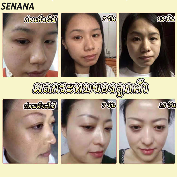 SENANAเซตครีมหน้าใส ครีมหน้าขาวใส ครีมทาฝ้า ครีมทาหน้าขาว ครีมรักษาฝ้า ครีมทาฝ้าหนาๆ ครีมทาฝ้าลึก ไวท์เทนนิ่งครีม ครีมทาผิวขาว(น้ำลดฝ้า120ml+เซรั่ม15ml+เอสเซ้นส์ลดฝ้า120ml+ครีมลดฝ้า50g)ครีมทาฝ้ากระ ครีมแก้ฝ้ากระ ครีมไวท์เทนนิ่ง ไวท์เทนนิ่งกระ ครัมบำรุง ... Senanaเซตครีมหน้าใส ครีมหน้าขาวใส ครีมทาฝ้า ครีมทาหน้าขาว ครีมรักษาฝ้า ครีมทาฝ้าหนาๆ ครีมทาฝ้าลึก ไวท์เทนนิ่งครีม ครีมทาผิวขาว(น้ำลดฝ้า120Ml+เซรั่ม15Ml+เอสเซ้นส์ลดฝ้า120Ml+ครีมลดฝ้า50G)ครีมทาฝ้ากระ ครีมแก้ฝ้ากระ ครีมไวท์เทนนิ่ง ไวท์เทนนิ่งกระ ครัมบำรุง ...