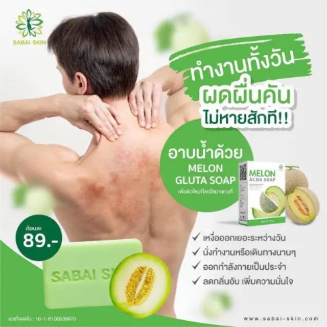 สบู่เมลอน melon acna soap 70g สบู่ผิวขาว สบู่ล้างหน้า สบู่ก้อน สบู่แก้เชื้อราผดผื่นคัน