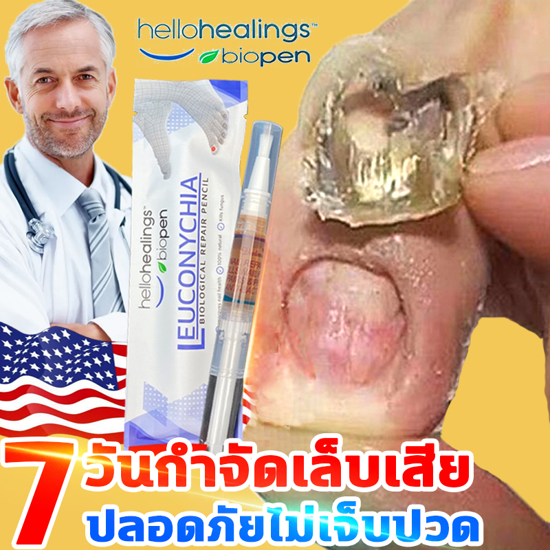 กำจัดเล็บเสียได้เร็ว Hellohealings เซรั่มรักษาเล็บ รักษาเล็บ เล็บเท้าคุณภาพสูงกำจัดเชื้อราที่เล็บ เอ็สเซ้นซ่อมแซมเล็บเสีย รักษารคเชื้อราที่เล็บ เล็บพัง เล็บขบ เซรั่มบำรุงเล็บ น้ำมันบำรุงเล็บ ดูแลเล็บ ครีมบำรุงซ่อมแซมเล็บ Nail Treatment Remove Onychomycosi