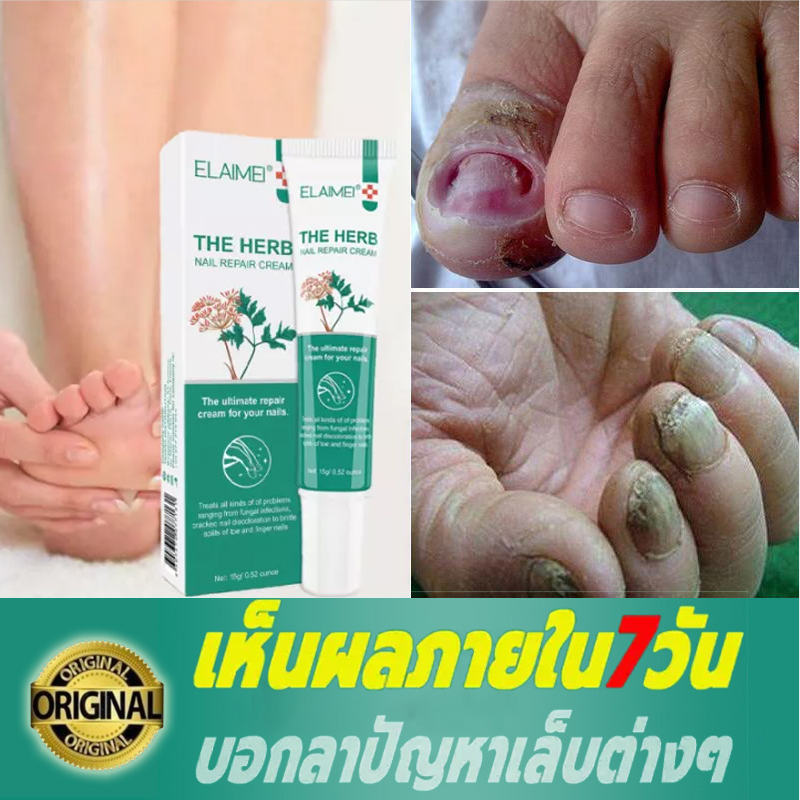 ELAIMEI เป็นร้านค้าที่ไทย สั่งแล้ว 13วันถึง ดูแลเล็บ ซ่อมแซมเล็บ ครีม