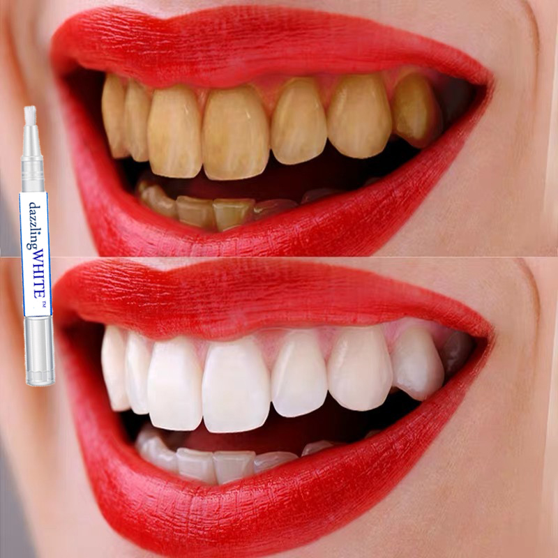 ฟอกฟันขาว ยาสีฟันฟันขาว ยาสีฟันฟันขาว บำรุงฟัน แก้ฟันเหลือง ขัดคราบเหลืองคราบพฟัน ดับกลิ่นปาก สดชื่น เซรั่มฟอกฟันขาว ปากกาฟันขาว