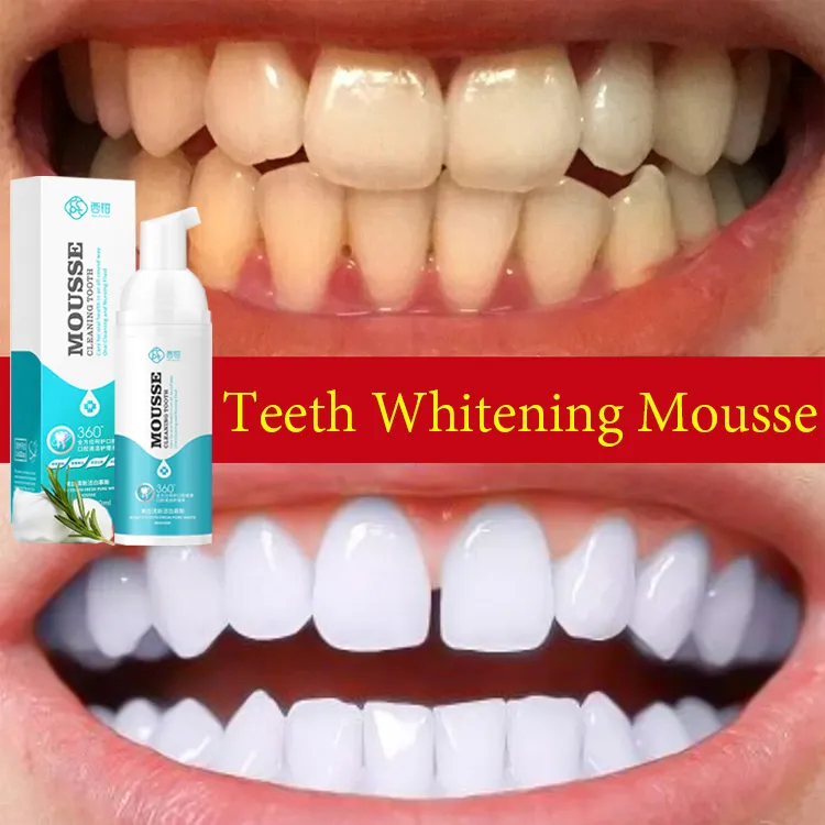 ฟอกฟันขาว ฟันขาว น้ำยาฟอกฟันขาว ที่ฟอกฟันขาว ยาสีฟัน มูสแปรงฟัน น้ำยาฟอกสีฟัน เซรั่มฟอกฟันขาว แก้ฟันเหลือง ขัดคราบเหลืองคราบพฟัน ดับกลิ่นปาก สดชื่น Teeth Whitening Mousse Toothpaste