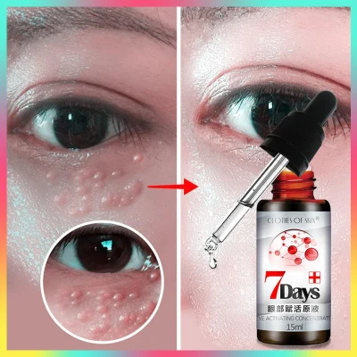 Eye Serum เซรั่ม อายครีม อายครีมบำรุงตา ครีมทารอบดวงตา ครีมทาใต้ตา ครีมลดถุงใต้ต 15ml Dark Circles In 7 Days Remove Eye Bags and Fat Particles Eye Serum Anti-Wrinkle Anti Puffiness Essence