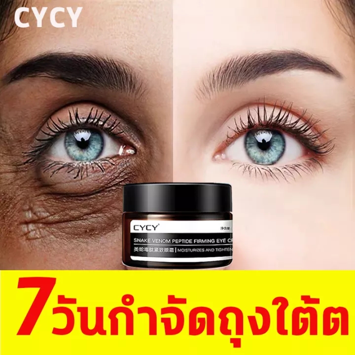 CYCYอายครีม ครีมบำรุง รอบดวงตา30g บำรุง ให้ความ ชุ่มชื่น ขอบตาดำ ถุงใต้ตา ริ้วรอย รอยตีนกา ริ้วรอยร่องแก้ม ลด ริ้วรอย Eye cream-1375