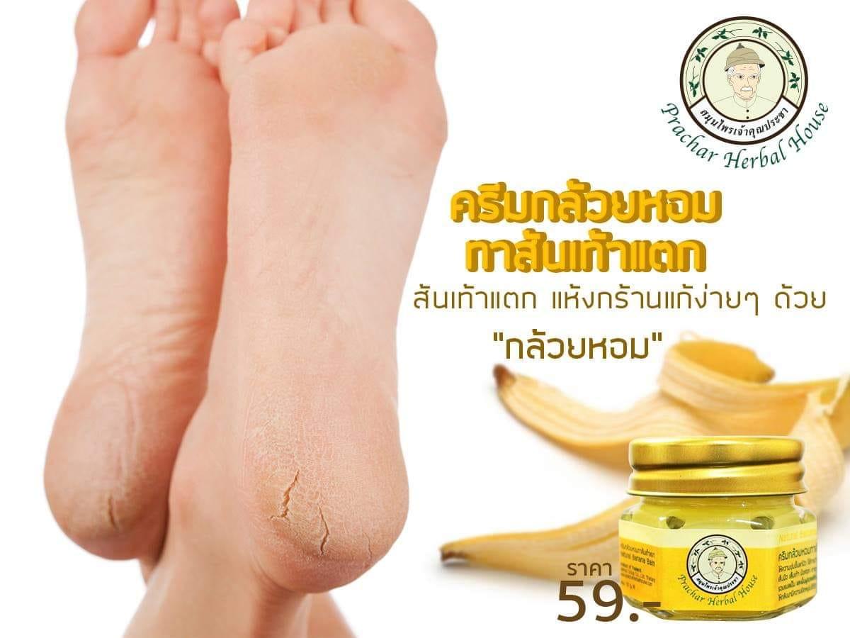 ครีมกล้วยหอมทาส้นเท้าแตก