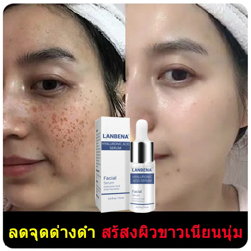 หน้าใส ไวท์เทนนิ่ง กระบนผิวหน้า เซรั่มวิตซี เซรั่มไฮยา เชรั่มหน้าใส serum essence เซรั่มหน้าใส เซรั่มบำรุงผิว น้ำตบ