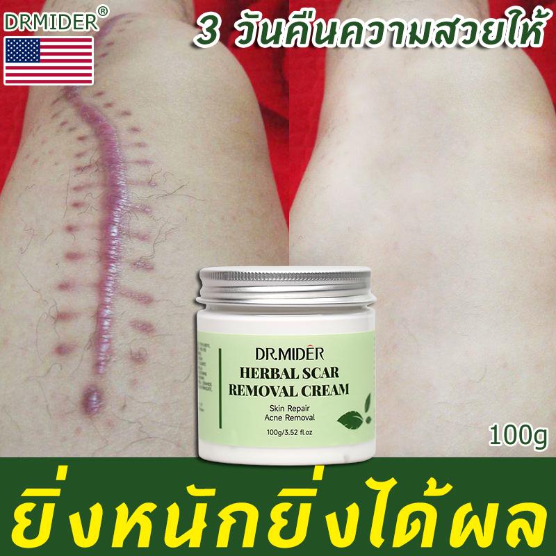 Drmider ยาทาแผลเป็น 100g ครีมทาแผลเป็น ครีมทาแผลเป็น ครีมลบแผลเป็น ครีมลบแผลเป็น ครีมลบรอย