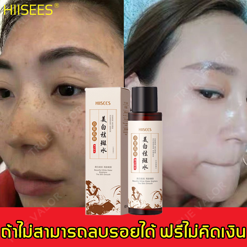 HIISEES Whitening serum 120ml ช่วยให้ใบหน้ากลับมาขาวใส ไม่มีจุดด่างดำบนใบหน้าอีกต่อไป ปรับสีผิวให้ขาวกระจ่างใส(ครีมทาฝ้ากระ,ครีมรักษาฝ้า,ครีมหน้าขาวใส,ครีมแก้ฝ้ากระ,ครีมทาฝ้าหนา,ครีมลดฝ้า,ครีมไวท์เทนนิ่งฝ้า,ครีมบำรุงหน้า,เช่รั่มทาฝ้า,ชุดรักษาฝ้ากระ)