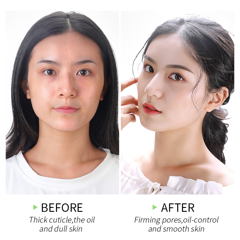 LAIKOU Matcha Exfoliating Peeling Gel Facial Scrub Moisturizing Whitening Nourishing Repair Scrubs Face Cream Skin Care
