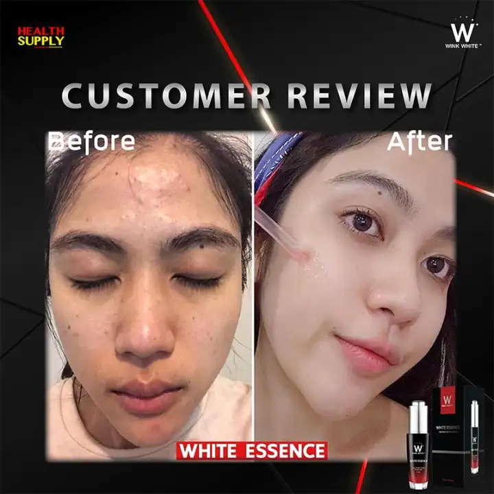 ส นค ามาใหม ล าส ด Wink White Essence Serum เอสเซ นส เซร มหน าใส ลดส ว ลดส วผด ไร ร วรอย กระช บร ข มขน ใบหน าเต งต ง ผ วหน าเด งเงาใสฉ ำวาว จ ดส งฟร 3 ขวด Lazada Co Th