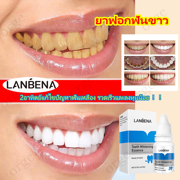 LANBENA 2อาทิตย์แก้ไขปัญหาฟันเหลือง ！！แก้ฟันเหลืองทำความสะอาดช่องปาลดกลิ่นปาก ยาฟอกฟันขาว ฟันขาว น้ำยาฟอกฟันขาว ฟอกฟันขาว ยาสีฟัน ฟอกฟันขาวแท้ ยาสีฟันฟอกขาว เจลฟอกฟันขาว เครื่องขัดฟัน ที่ฟอกฟันขาว ยาสีฟันฟอกฟันขาว ทำความสะอาดฟัน Teeth whitening