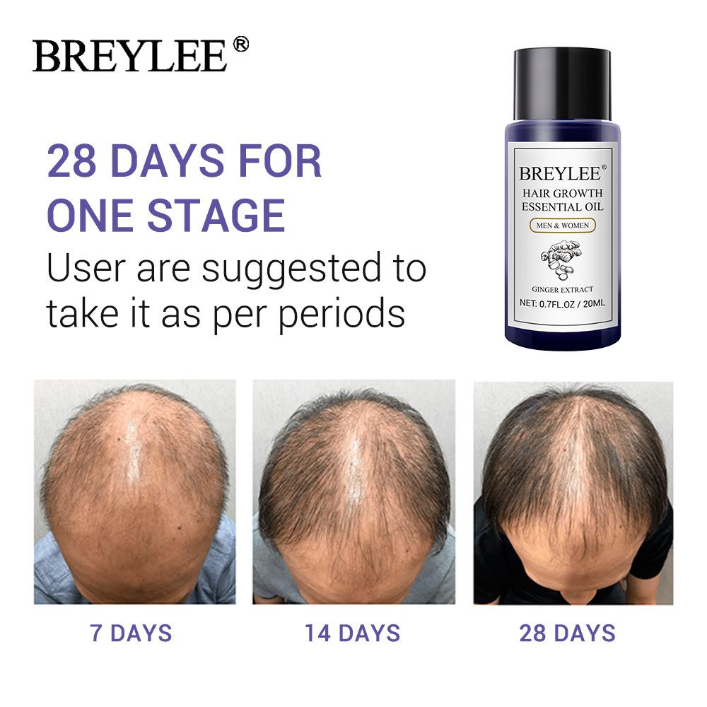 โปรโมชั่น BREYLEE Hair tonic Hair growth essence ปลูกผม บำรุงผม รักษาผม
