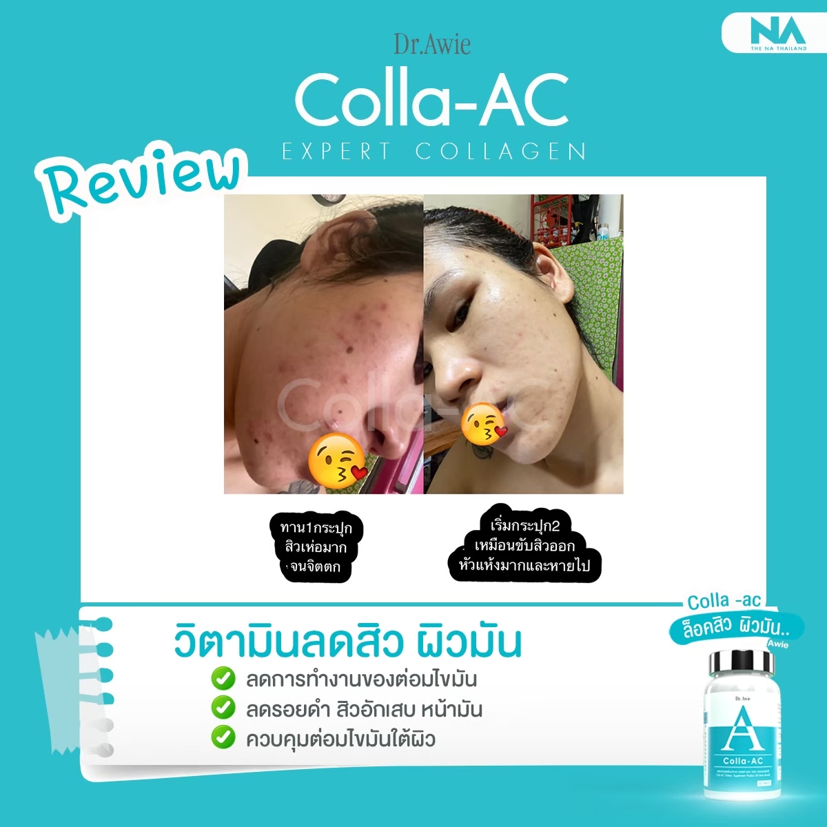 เกี่ยวกับ awie Colla-AC คอลาแอค 1 กระปุก 30 แคปซูล